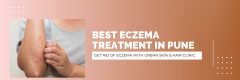 Eczema Specialist in Pune | Dr Kiran and Dr. Nitin
