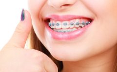 Best orthodontists in Bangalore - Braces, Invisible braces