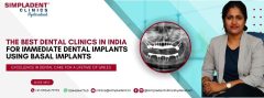 Basal Implants Hyderabad -Immediate Loading Dental Implants In Hyderabad