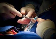 Minimally Invasive Cardiac Surgery in Bangalore | Expert Surgeon | drsudharsan
