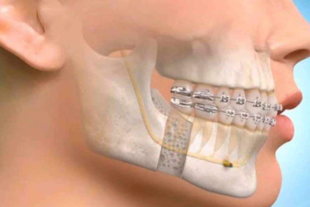 understanding oral and maxillofacial surgery an in depth exploration blog