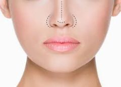 Best Rhinoplasty Surgeon in Bangalore | Nose Reshaping Surgery | drrajendra