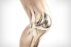 Robotic Primary & Revision Knee Replacement Surgeon In Kurnool | Dr. Y. HariPrasad Reddy