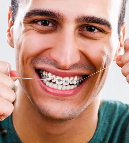 clear aligners 1