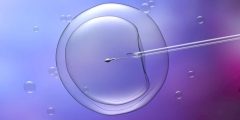 IVF Specialist in Delhi, India