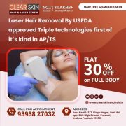 best pulsed dye laser treatment in india
