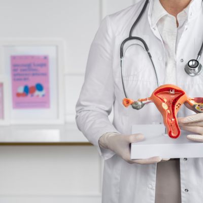 ayurvedic doctor for pcos 1