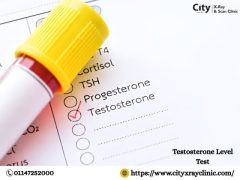 Testosterone Test Price Know the Cost & Benefits
