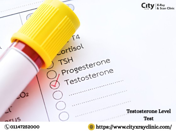 testosterone level test
