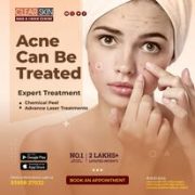 Pulse dye laser treatment in india | Clear Skin Hair & Laser