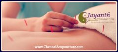 Jayanth Acure Health Care, Chennai | Acupuncture | Cupping Therapy | Foot Reflexology