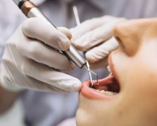 Best Dentist in Ludhiana | Smilecarecentre