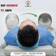 Hair surgery price | Ulyrabiohair