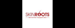 Best Hair transplant In Delhi - SKinroots Clinic